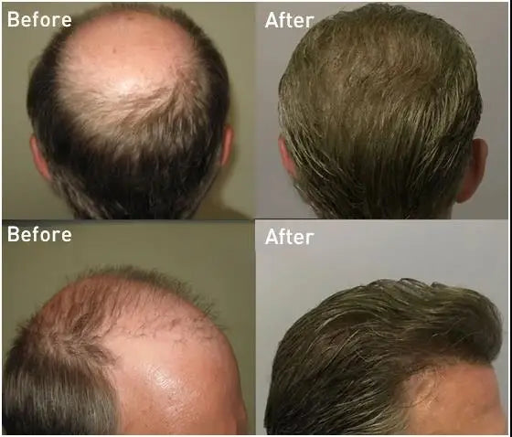 Indian Human Hair Thin Skin Hair Prosthesis 0.12 - 0.14 mm Toupee/Replacement Unit - Various Options Available