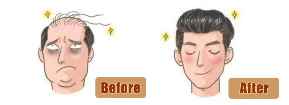 Hair Replacement System (Toupee) - Human Hair Fine Mono NPU, Various Curl Patterns Available