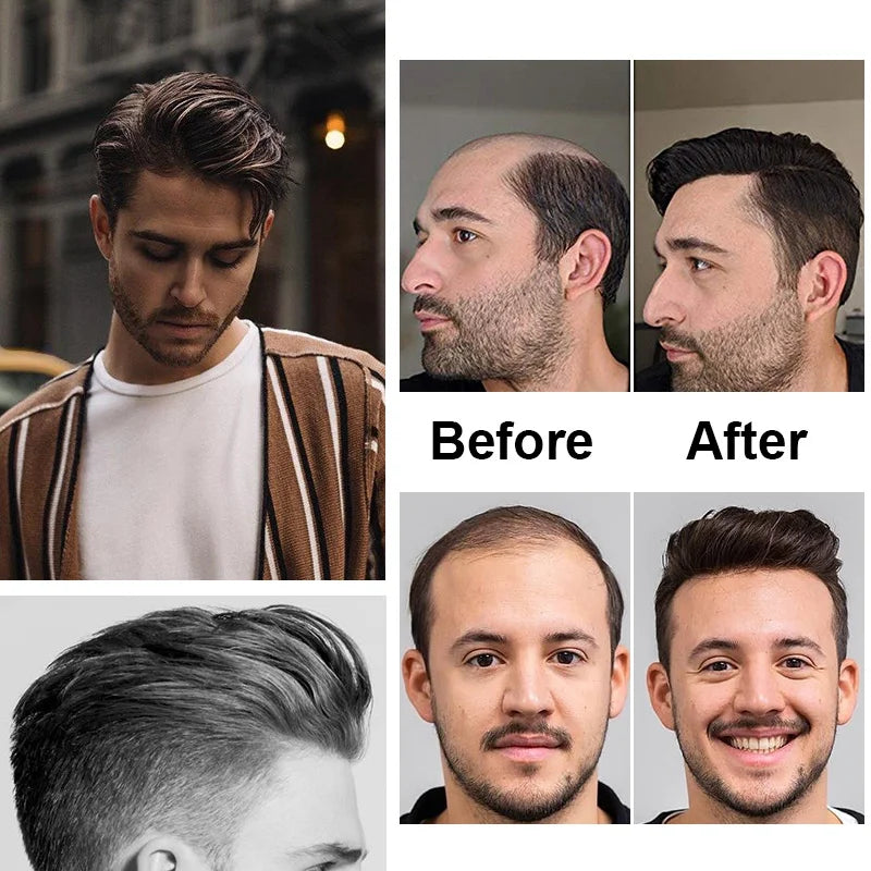 V Frontal Men Toupee Thin Skin PU 2.5x16 V Loop Human Hair Invisible Forehead Hairline