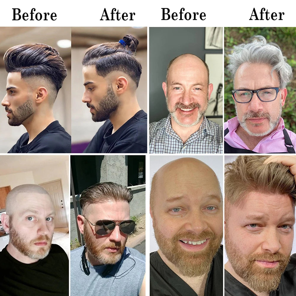 Natural Hairline Toupee Human Hair Double Knots Hair System - Various Options Available