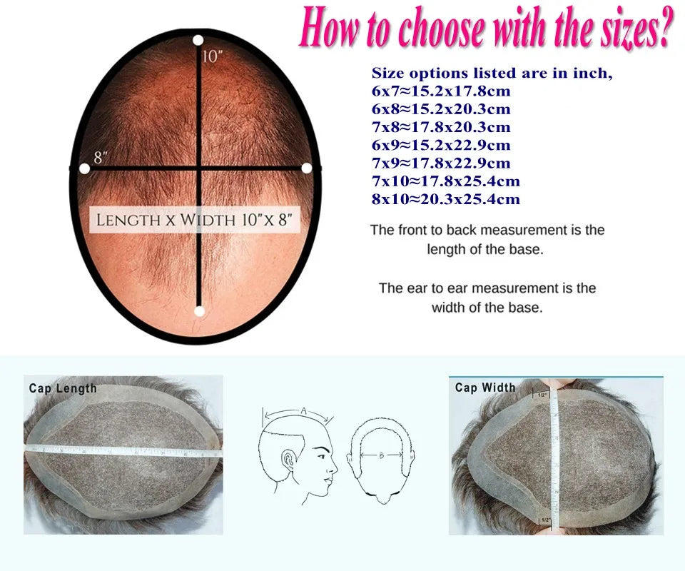 Full Skin Base 20mm Curly Human Hair- Durable Prosthesis System With Natural Frontline - Various Colors Available