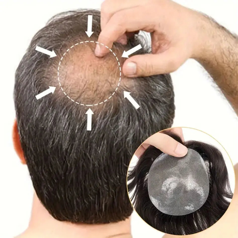 Side or Back Hair Patches Hairpiece for Men, Thin Skin, Toupee Patch, 8cm x 8cm - Various Options Available