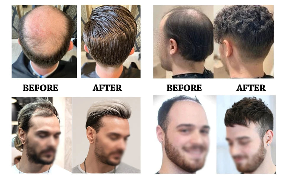 Natural Hairline Toupee Human Hair Double Knots Hair System - Various Options Available