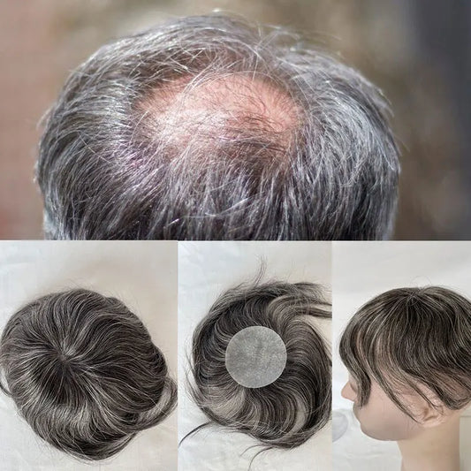 Side or Back Hair Patches Hairpiece for Men, Thin Skin, Toupee Patch, 8cm x 8cm - Various Options Available