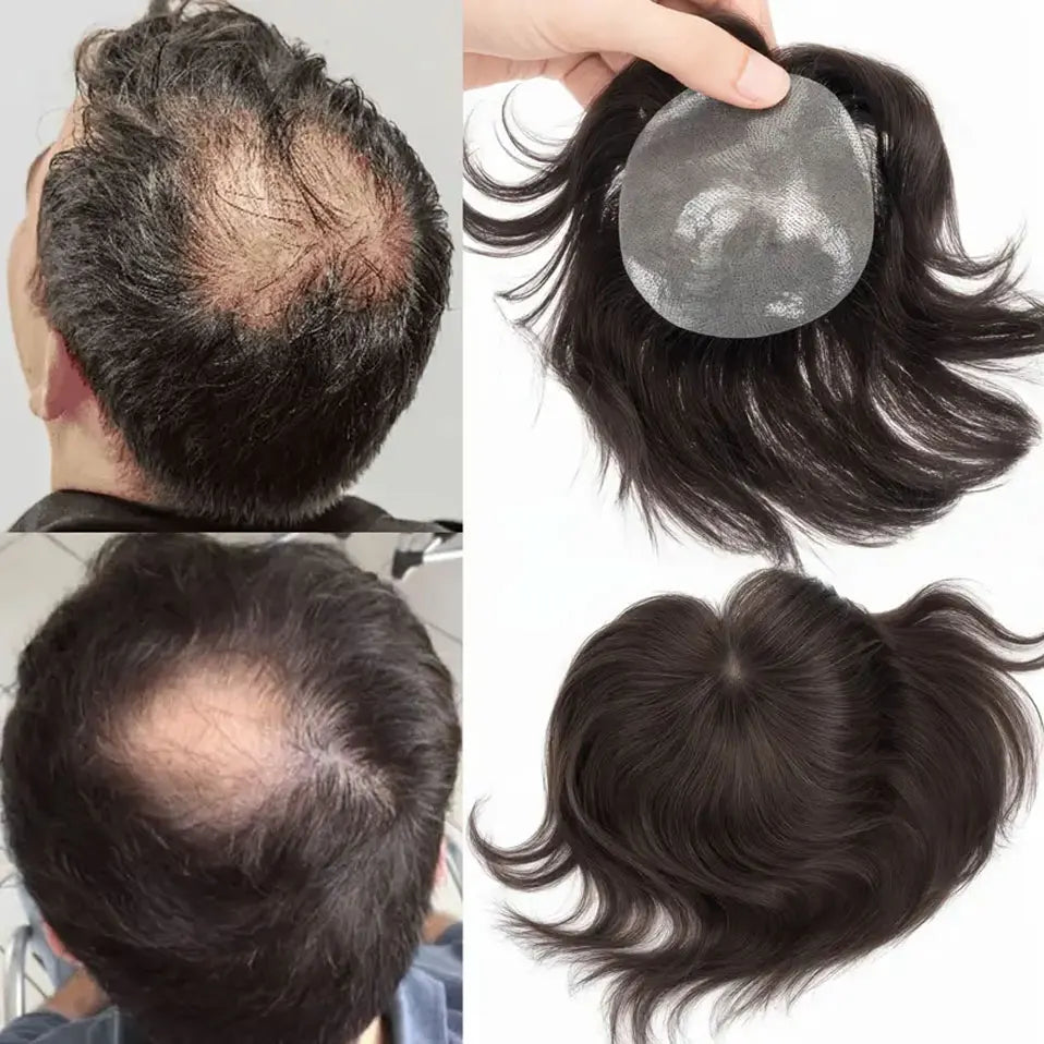Side or Back Hair Patches Hairpiece for Men, Thin Skin, Toupee Patch, 8cm x 8cm - Various Options Available