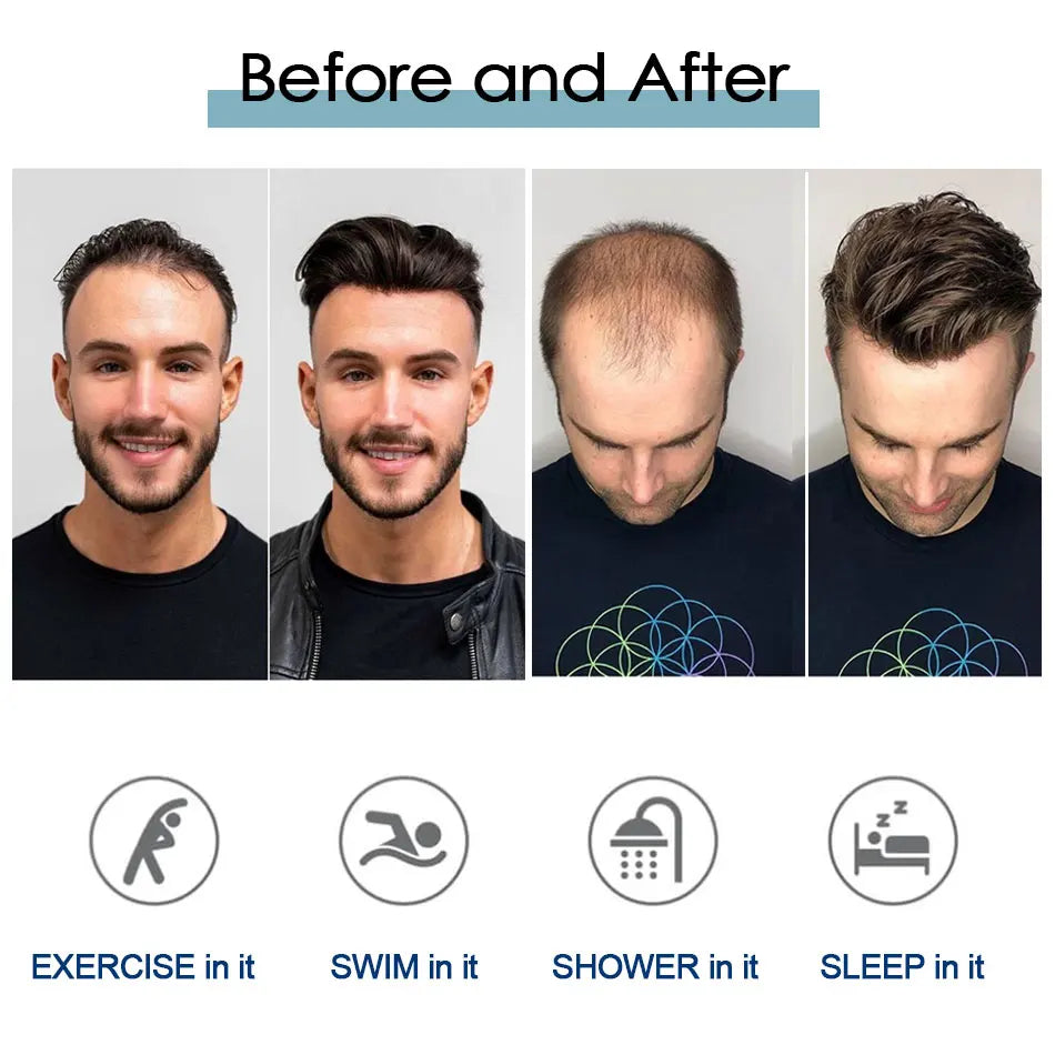 Mono Lace Men's Skin Pu Around Toupee Prosthesis Remy Human Hair Systems - Various Options Available