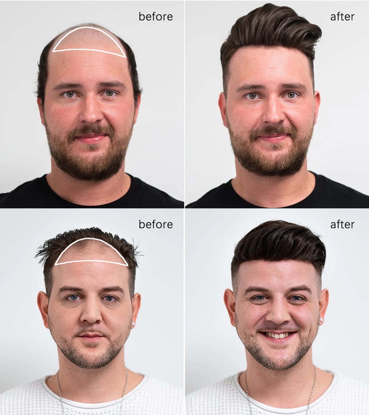 Human Hair 0.06-0.08mm Full PU Skin Base Toupee/Replacement Units - Various Options Available