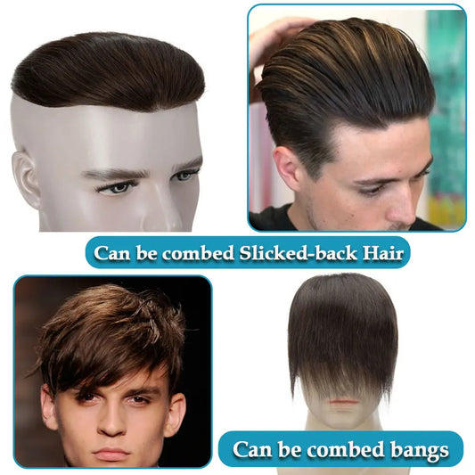7X15cm Frontal - Straight Human Hair Replacement Topper - Various Options Available